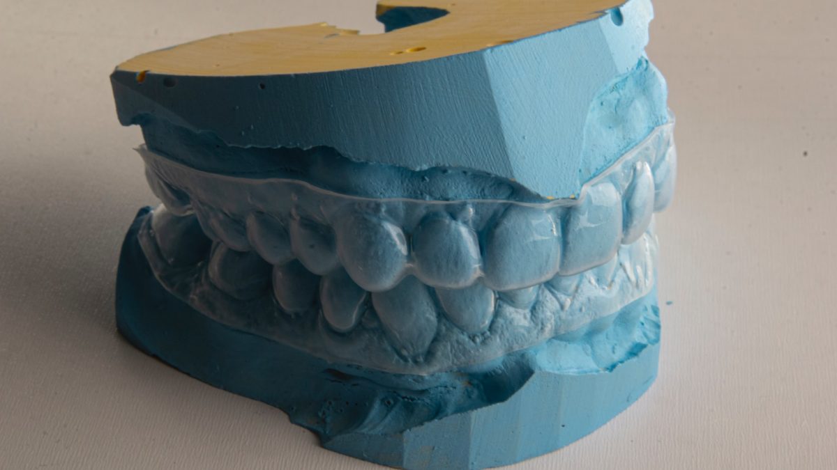 Jak wybrać dobre i nowoczesne laboratorium dentystyczne?